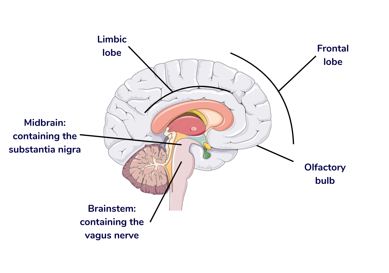 Diagram of some of the areas of the brain impacted by Parkinson's