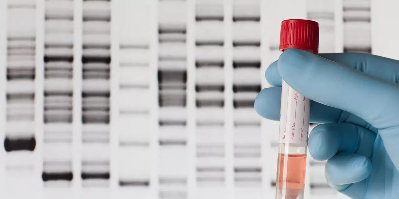 Genetic test 