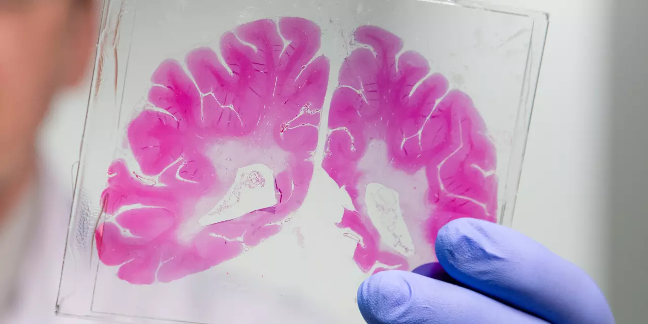 A brain bank tissue sample stained in pink