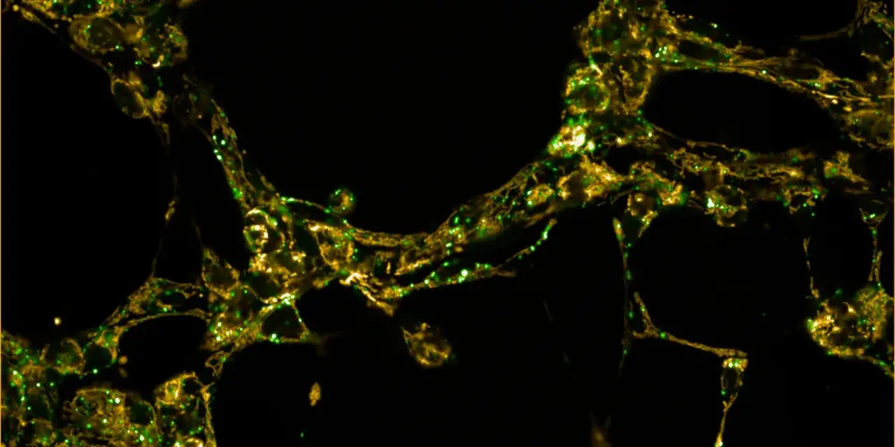 Image of brain cells under microscope