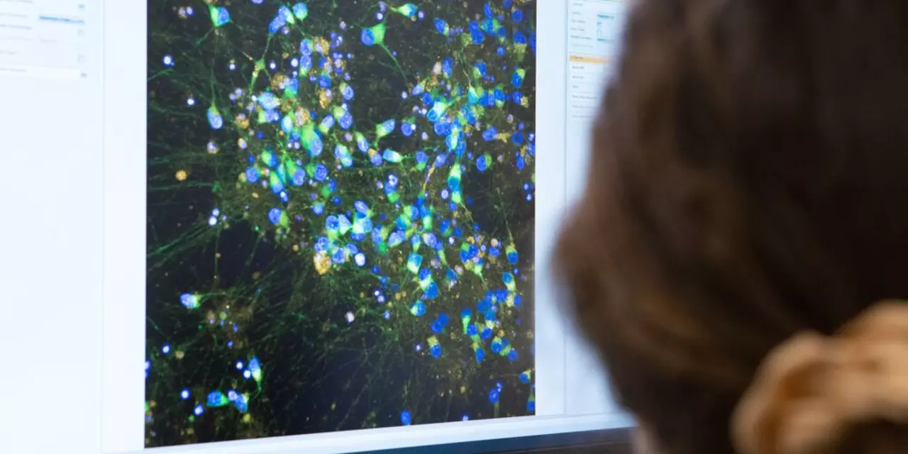 Researcher using computer to analyse cells