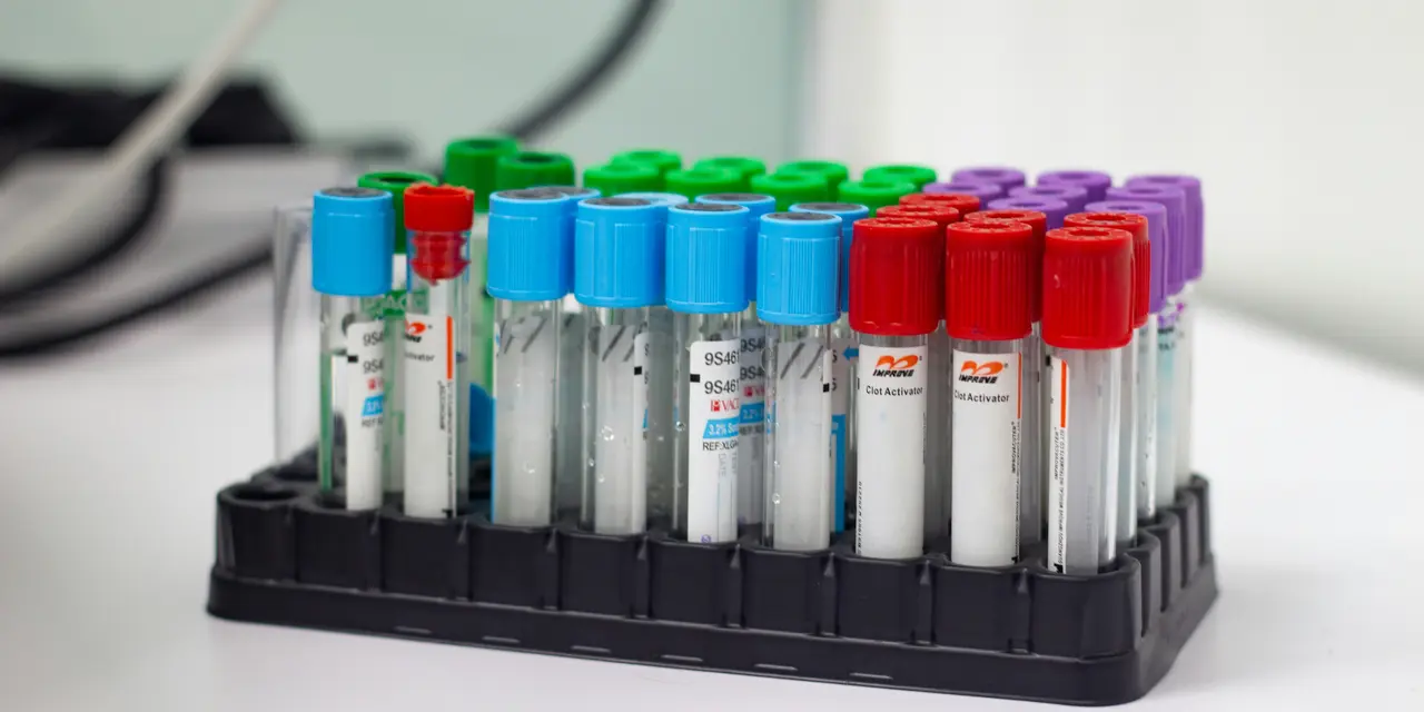 A rack of test tubes with blue, green and purple lids in a laboratory setting.