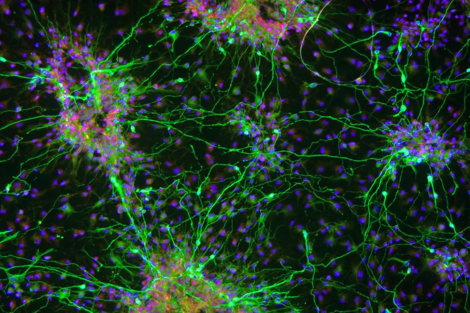 Progress towards stem cell treatment for Parkinson’s | Parkinson's UK